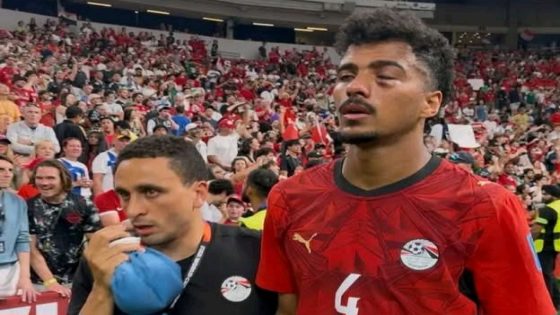 حسام عبد المجيد خارج حسابات منتخب مصر أمام إيران رغم سلامة الأشعة